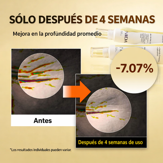 HIZENIVA™ Crema Revitalizante Contorno de Ojos